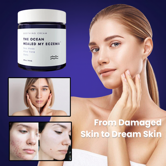 Eczema™ - Stop suffering from irritations or burns