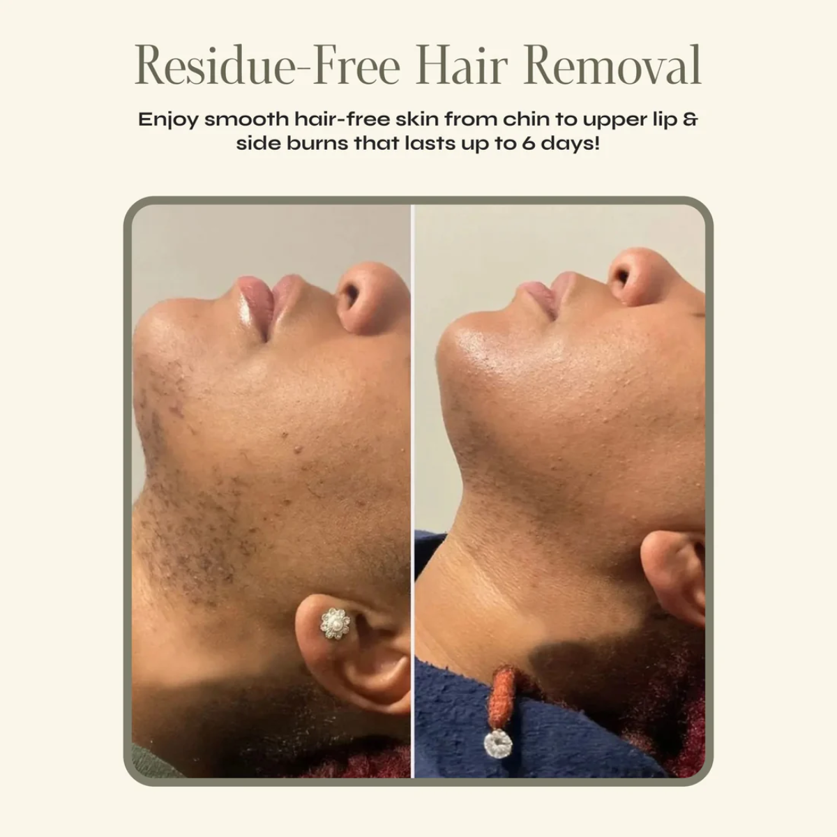 Luuma™ - Say Bye-Bye to Stubborn Stubble