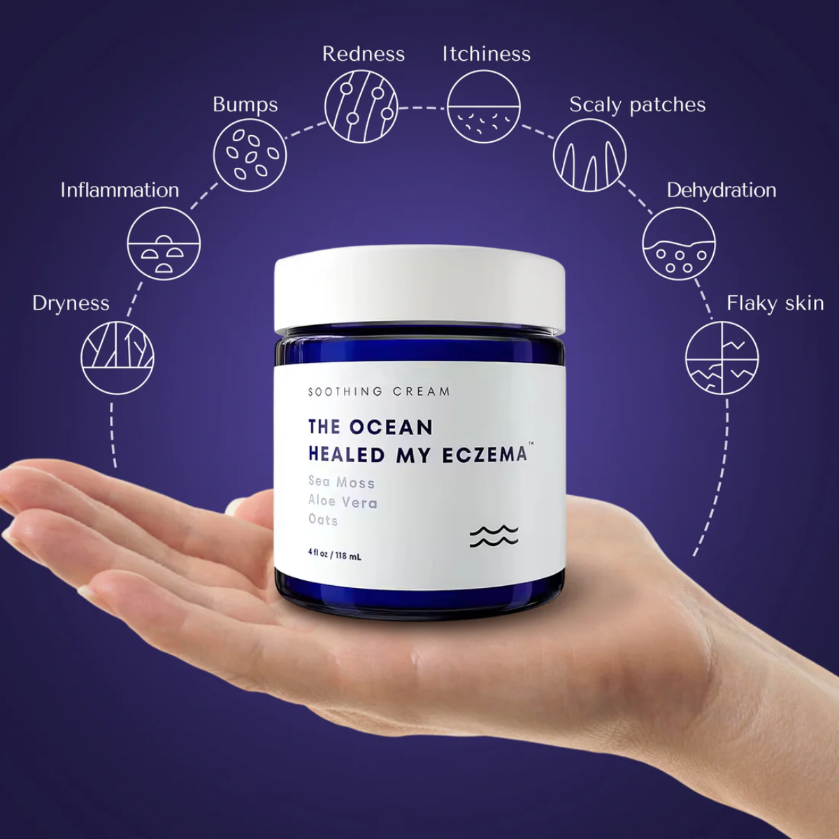 Eczema™ - Stop suffering from irritations or burns