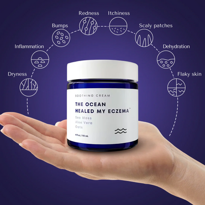 Eczema™ - Stop suffering from irritations or burns